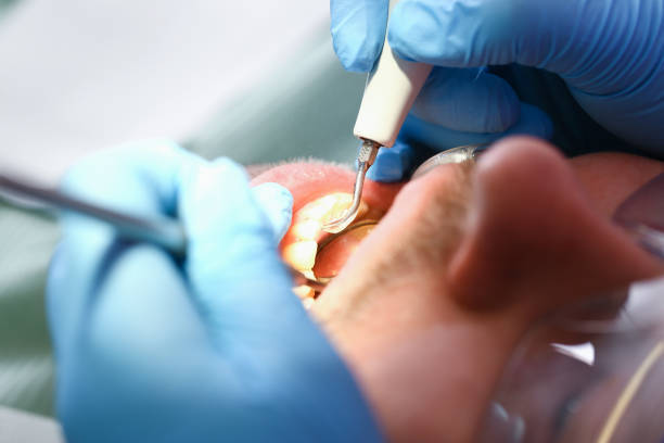 Best Orthodontic Emergency Dentist in Mount Repose, OH