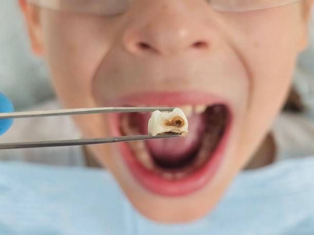Best Emergency Dental Services for Seniors in Mount Repose, OH